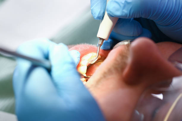 Best Emergency Dentist for Special Needs Patients in Ashley, OH